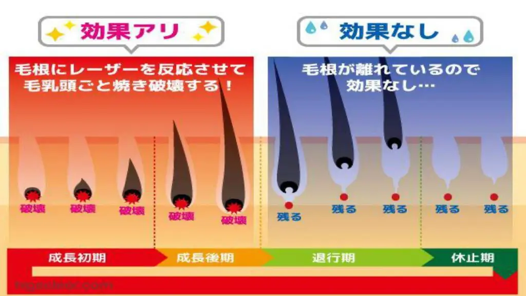 医療レーザー脱毛 | 鬼沢ファミリークリニック
