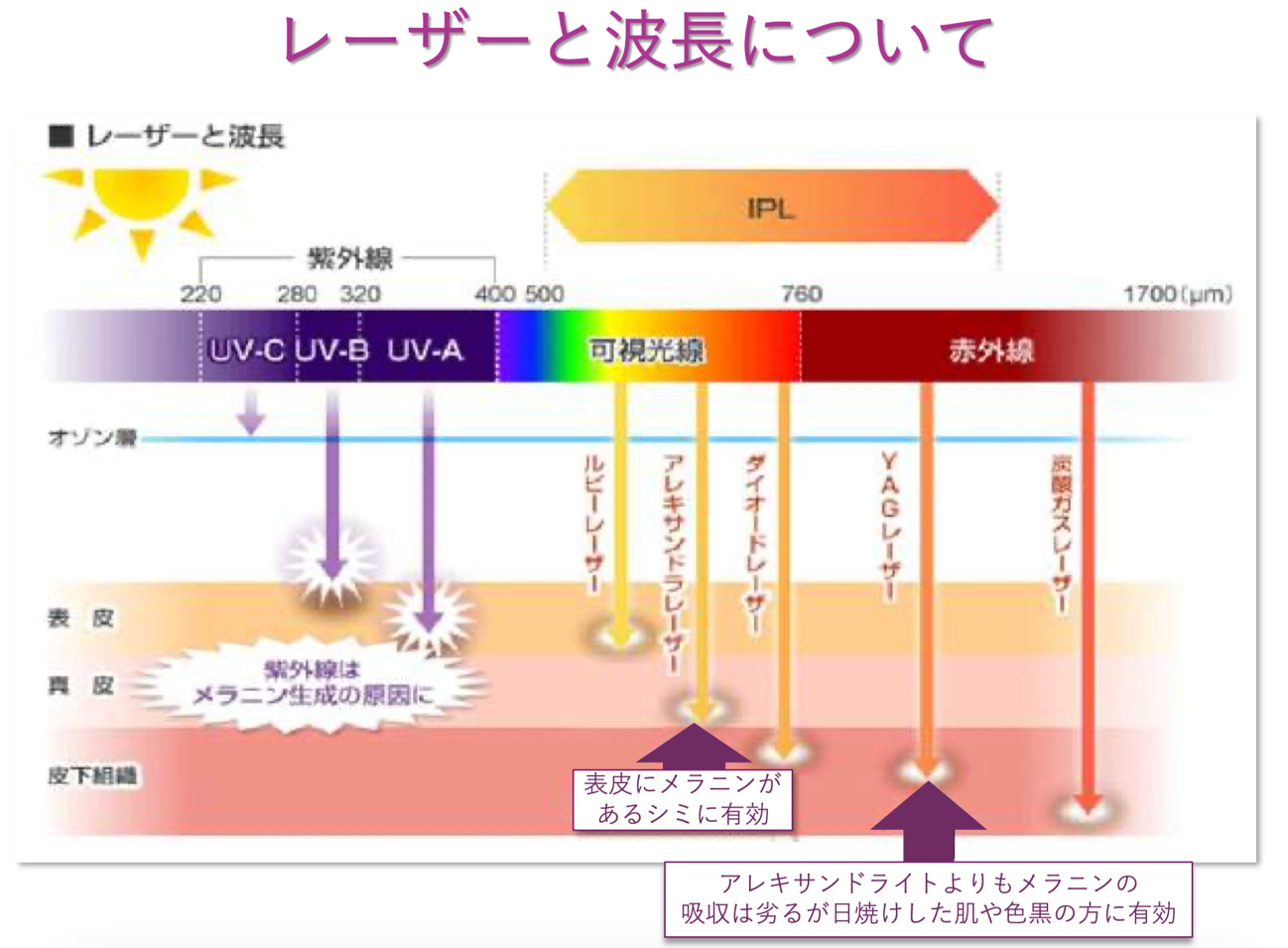 【画像】レーザーと波長について